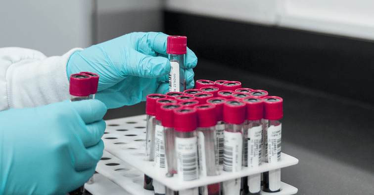 Testy na protilátky po očkovaní a prekonaní Covid-19: Koľko stoja a kde sa môžete otestovať